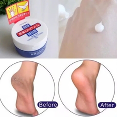 Kem Dưỡng Trị Nứt Nẻ Tay Chân Shiseido Urea Cream 100g