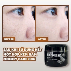 Kem Dưỡng Mommy Care Perilla Whitening Cream Plus 50g