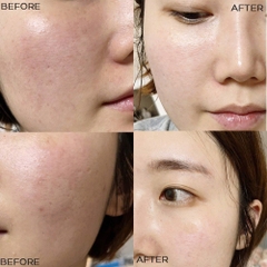 Kem Dưỡng Trắng Medi-Peel Bio-Intense Glutathione White Cream 50g