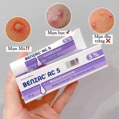 Chấm mụn 5% Benzoyls Peroxide Benzac 15g