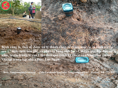 SIÊU CANXI BO ĐẬM ĐẶC