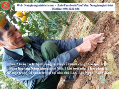 SIÊU CANXI BO ĐẬM ĐẶC