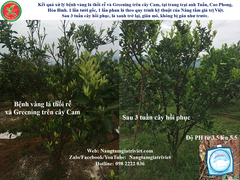 SIÊU CANXI BO ĐẬM ĐẶC