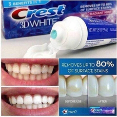 KEM ĐÁNH RĂNG CREST 3D WHITE RADIANT MINT 170gam/ tuýp
