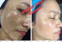 Biocomestic