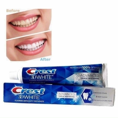 𝗞𝗲𝗺 Đ𝗮́𝗻𝗵 𝗥𝗮̆𝗻𝗴 𝗖𝗿𝗲𝘀𝘁 𝟯𝗗 𝗔𝗱𝘃𝗮𝗻𝗰𝗲𝗱 𝗧𝗿𝗶𝗽𝗽𝗹𝗲 𝗪𝗵𝗶𝘁𝗲𝗻𝗶𝗻𝗴 𝟭𝟱𝟴𝗴