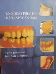 Tổng quan phục hình tháo lắp toàn hàm