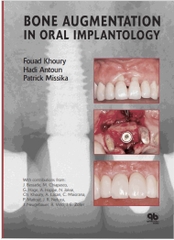 Sách bone AUGMENTATION IN ORAL IMPLANTOLOGY – FOUAD KHOURY,HADI ANTOUN,PATRICK MISSIKA – © 2007