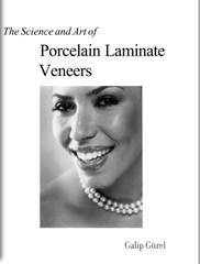 Sách The science and Art of Porcelain Laminate Veneers (2003)