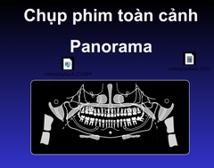 Sách chụp phim toàn cảnh panorama