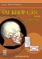 Sách sai khớp cắn