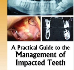 Sách A Practical Guide to the Management of Impacted Teeth - Jaypee Brothers_ 1 edition