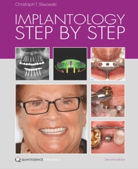 Sách implantology Step by Step ,2ed