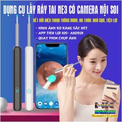 DỤNG CỤ LẤY RÁY TAI NE3 CÓ CAMERA NỘI SOI KẾT NỐI ĐIỆN THOẠI THÔNG MINH, AN TOÀN, NHỎ GỌN, TIỆN LỢI