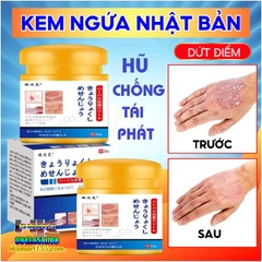 COMBO KEM ĐẶC TRỊ DỨT ĐIỂM VÀ NGỪA TÁI PHÁT NẤM NGỨA VẢY NẾN Á SỪNG NHẬT BẢN [CHUẨN 100% HÀNG CTY]