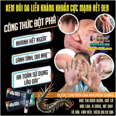 [CHUẨN 100% HÀNG CTY] KEM BÔI DA LIỄU KHÁNG KHUẨN CỰC MẠNH RẾT ĐEN-CHUYÊN CÁC BỆNH DA LIỄU NẤM NGỨA, HẮC LÀO, MỀ ĐAY…