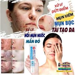 KEM CHẤM MỤN CẤP TỐC DONGNAIER 25GR- LOẠI BỎ NHANH CHÓNG CÁC LOẠI MỤN, MỤN BỌC, MỤN MỦ, MỤN ĐẦU ĐEN,MỤN Ở TUỔI DẬY THÌ, LOẠI BỎ NHỜN DA DẦU