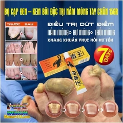 KEM BÔI KHÁNG KHUẨN ĐẶC TRỊ NẤM NGỨA, NẤM MÓNG TAY CHÂN BỌ CẠP ĐEN 15GR- NỘI ĐỊA TRUNG [CHUẨN 100% HÀNG CTY]