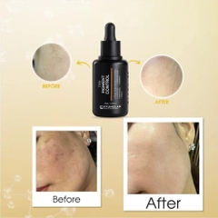 Serum Kyung Lab TRX Pigment Control