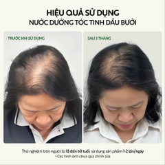 Nước dưỡng tóc tinh dầu bưởi Cocoon ngăn ngừa gãy rụng, hỗ trợ mọc tóc