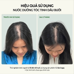 Nước dưỡng tóc tinh dầu bưởi Cocoon ngăn ngừa gãy rụng, hỗ trợ mọc tóc