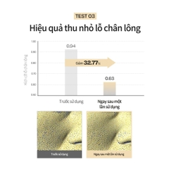 Toner serum d'Alba giúp dưỡng ẩm, cải thiện lỗ chân lông Vita Toning Serum Toner 180ml