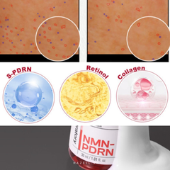 Tinh chất thu nhỏ lỗ chân lông CNP Derma Answer Pore Firming Ampule NMN-PDRN  30ml - HNK