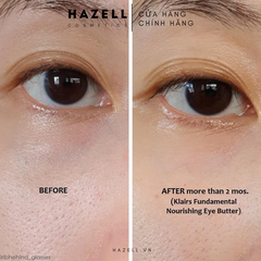 Kem dưỡng da mắt Dear, Klairs Fundamental Nourishing Eye Butter 20g - HNK