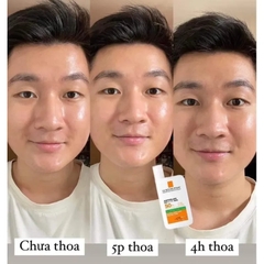 Kem chống nắng LA ROCHE-POSAY Anthelios UVmune 400 Fluide Oil Control SPF50+ 50ml (Lọ dẹp kẻ xanh lá)