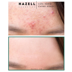 Kem dưỡng trị mụn SOME BY MI AHA-BHA-PHA 30 Days Miracle Cream 60g - HNK