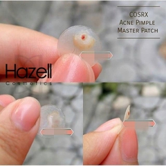 Miếng dán mụn COSRX Acne Pimple Master Patch