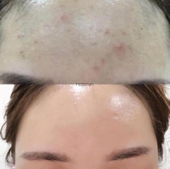 Kem dưỡng trắng, trẻ hoá da ZO Skin Health Retinol Skin Brightener 1%