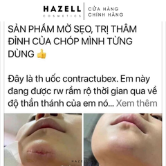 Kem trị sẹo Contractubex Merz