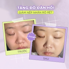Kem dưỡng By Wishtrend Vitamin A-Mazing Bakuchiol Night Cream 30g - HÀNG NHẬP KHẨU