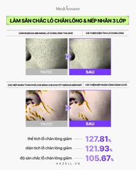 Mặt nạ thạch MediAnswear Retinol Liftxyl Mask - HNK