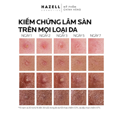 Kem dưỡng giảm mụn LA ROCHE-POSAY Effaclar Duo+ M