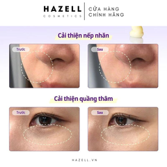 Kem dưỡng mắt SOME BY MI Retinol Intense Advanced Triple Action Eye Cream - HÀNG NHẬP KHẨU