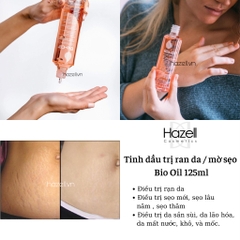 Tinh dầu trị ran da / mờ sẹo Bio Oil