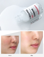 Tinh chất MEDI-PEEL Bio-Intense Glutathione White Ampoule 30ml