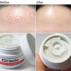 Kem trị mụn Ciracle Red Spot Cream 30g
