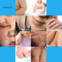 Kem dưỡng LA ROCHE-POSAY Cicaplast Baume B5 40ml - HÀNG NHẬP KHẨU