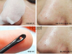 Mặt nạ đẩy mụn đầu đen Goodbye BlackHead Ciracle