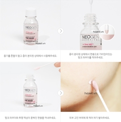 Dung dịch chấm mụn Neogen Dermalogy A-Clear Aid Soothing Pink Eraser 15ml