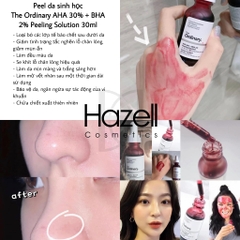 Peel da The Ordinary AHA 30% + BHA 2% 30ml (Bản Canada)