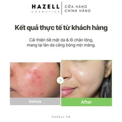 Toner Pad Medicube Exosome Cica Calming Pad 150ml/100 miếng - HÀNG NHẬP KHẨU