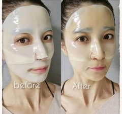 Mặt nạ Medi Answer Vita Collagen Mask (Vàng)