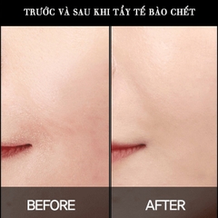 Dung dịch loại bỏ tế bào chết Paula's Choice Skin Perfecting 2% BHA Liquid Exfoliant