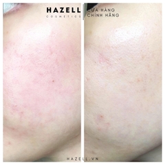 Tinh Chất Ciracle Hydra B5 Source 30ml - HÀNG NHẬP KHẨU