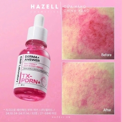 Tinh chất CNP Derma Answer Pink Toning Shot Ampoule TX-PDRN 30ml - HNK