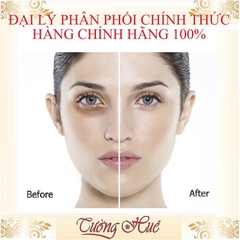 Kem Làm Mờ Thâm Mắt KUMARGIC Nhật Bản - 20g
